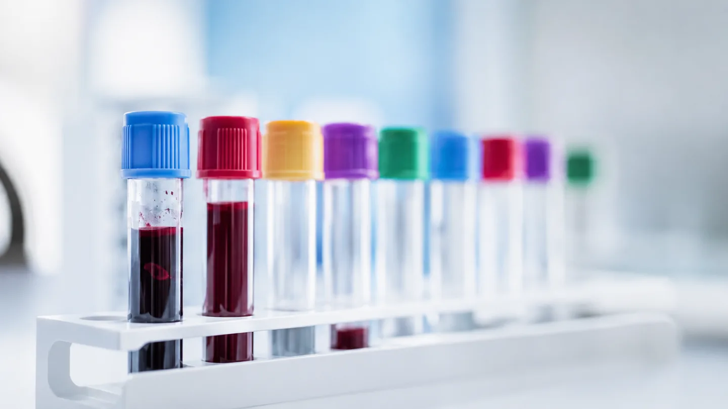 Colour-capped blood collection tubes in a laboratory rack